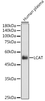 Anti-LCAT Antibody