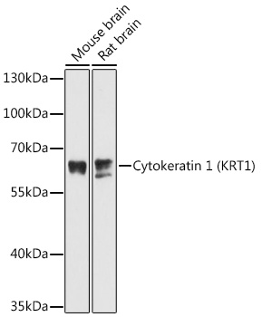 Anti-Cytokeratin 1 Antibody