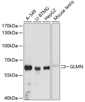 Anti-GLMN Antibody