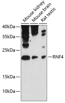 Anti-RNF4 Antibody