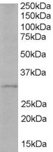 Anti-TIRAP Antibody - Identical to Novus (NB300-990)
