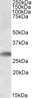 Anti-TREML1 Antibody - Identical to Abcam (ab91480) and Novus (NBP1-45208)