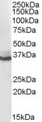 Anti-AKR1C4 Antibody - Identical to Abcam (ab50415)