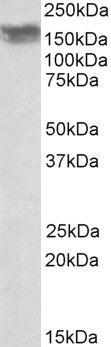 Anti-NCAM1 Antibody - Identical to Abcam (ab118291)