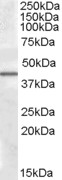 Anti-CAMK1D Antibody - Identical to Novus (NBP1-28803)