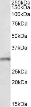 Anti-FGF14 Antibody - Identical to Abcam (ab156824)
