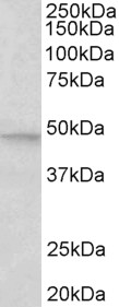 Anti-JNK2 Antibody - Identical to Abcam (ab133158)