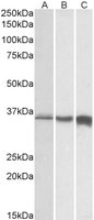 Anti-TNNT3 Antibody (Biotin)