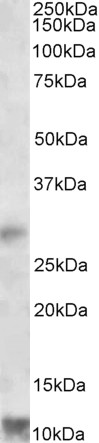 Anti-RNF7 Antibody - Identical to Novus (NBP1-46159)