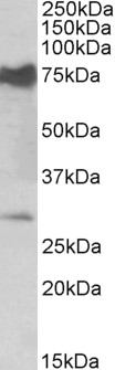 Anti-NMNAT3 Antibody - Identical to Abcam (ab121030)