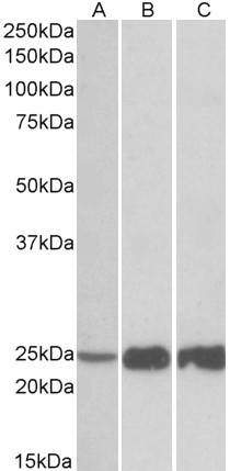 Anti-TNNI2 Antibody - Identical to Novus (NBP2-26200)