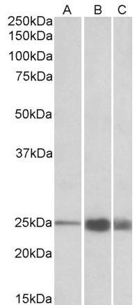 Anti-TNNI2 Antibody - Identical to Abcam (ab174765)