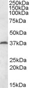 Anti-MEST Antibody - Identical to Abcam (ab95453)