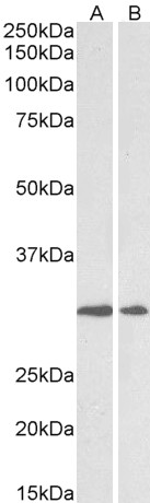 Anti-LOX Antibody - Identical to Abcam (ab223488)