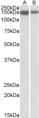 Anti-MCF2L Antibody