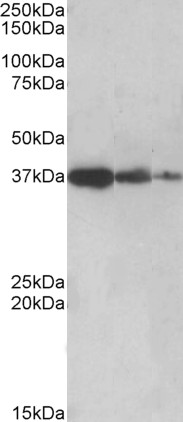 Anti-PPP2R4 Antibody - Identical to Abcam (ab87673) and Novus (NBP1-51951)