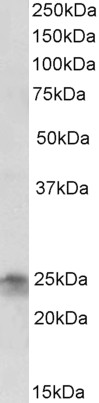 Anti-FGF8 Antibody - Identical to Abcam (ab181492)