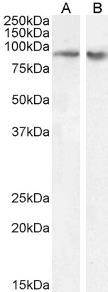 Anti-FBXO11 Antibody - Identical to Abcam (ab239219)