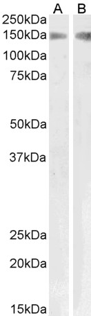Anti-PLA2R1 Antibody - Identical to Abcam (ab99466) and Novus (NBP1-46116)