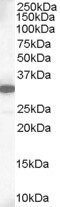 Anti-MCL1 Antibody - Identical to Abcam (ab16013)