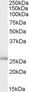 Anti-TPD52L1 Antibody - Identical to Abcam (ab77339) and Novus (NBP1-06091)