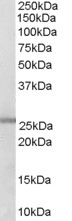 Anti-GSTM1 + GSTM2 Antibody - Identical to Abcam (ab27489) and Novus (NB300-932)