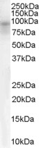 Anti-DPP10 Antibody - Identical to Abcam (ab111985)