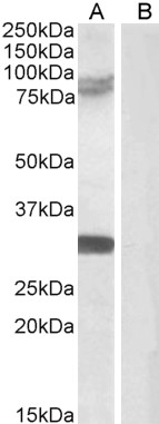 Anti-TRIM2 Antibody - Identical to Abcam (ab3942) and Novus (NB100-1218)