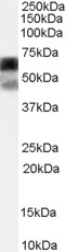 Anti-P4HA1 Antibody - Identical to Abcam (ab59497) and Novus (NB100-57852)