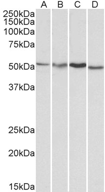 Anti-AKT3 Antibody