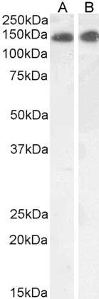 Anti-LEPR Antibody - Identical to Abcam (ab50424)