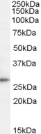 Anti-TPD52 Antibody - Identical to Abcam (ab77327)