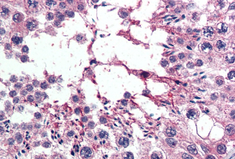 Anti-XPO7 Antibody - Identical to Abcam (ab6041) and Novus (NB100-1378)
