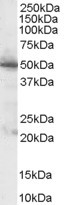 Anti-PDHX Antibody - Identical to Abcam (ab31283) and Novus (NB100-1496)