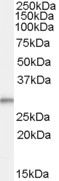 Anti-TPD52L2 Antibody - Identical to Abcam (ab77337) and Novus (NBP1-06092)