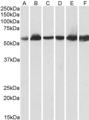 Anti-HSPD1 Antibody