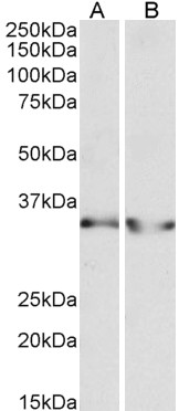 Anti-LDHB Antibody - Identical to Abcam (ab195964)