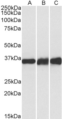 Anti-LDHB Antibody - Identical to Abcam (ab240482)