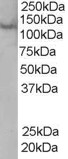 Anti-ZFYVE20 Antibody