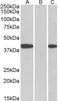 Anti-FANCF Antibody - Identical to Abcam (ab109585) and Novus (NBP1-51916)