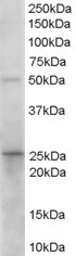 Anti-HPGD Antibody - Identical to Abcam (ab115577) and Novus (NB100-1482)