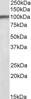 Anti-Huntingtin Associated Protein 1 Antibody