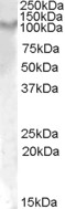 Anti-IL17RA Antibody