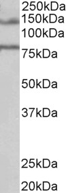 Anti-EPB41L5 Antibody - Identical to Abcam (ab78607) and Novus (NB100-93392)