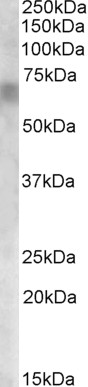 Anti-RPE65 Antibody - Identical to Abcam (ab77381)