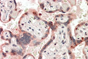 Anti-TDGF1 Antibody - Identical to Novus (NBP1-68841)