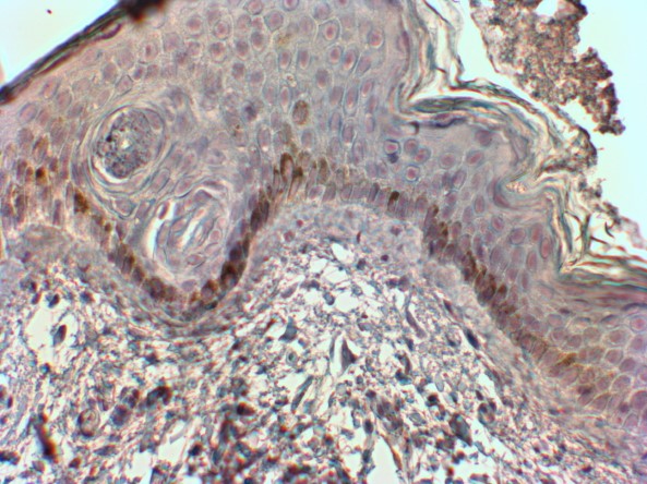 Anti-CMA1 Antibody - Identical to Abcam (ab123510)