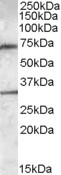 Anti-LIPG Antibody - Identical to Novus (NBP1-05031)