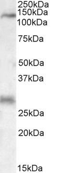 Anti-MAP3K6 Antibody - Identical to Abcam (ab99426) and Novus (NBP1-51977)