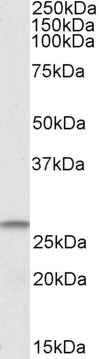 Anti-CHCHD3 Antibody - Identical to Novus (NBP1-52008)